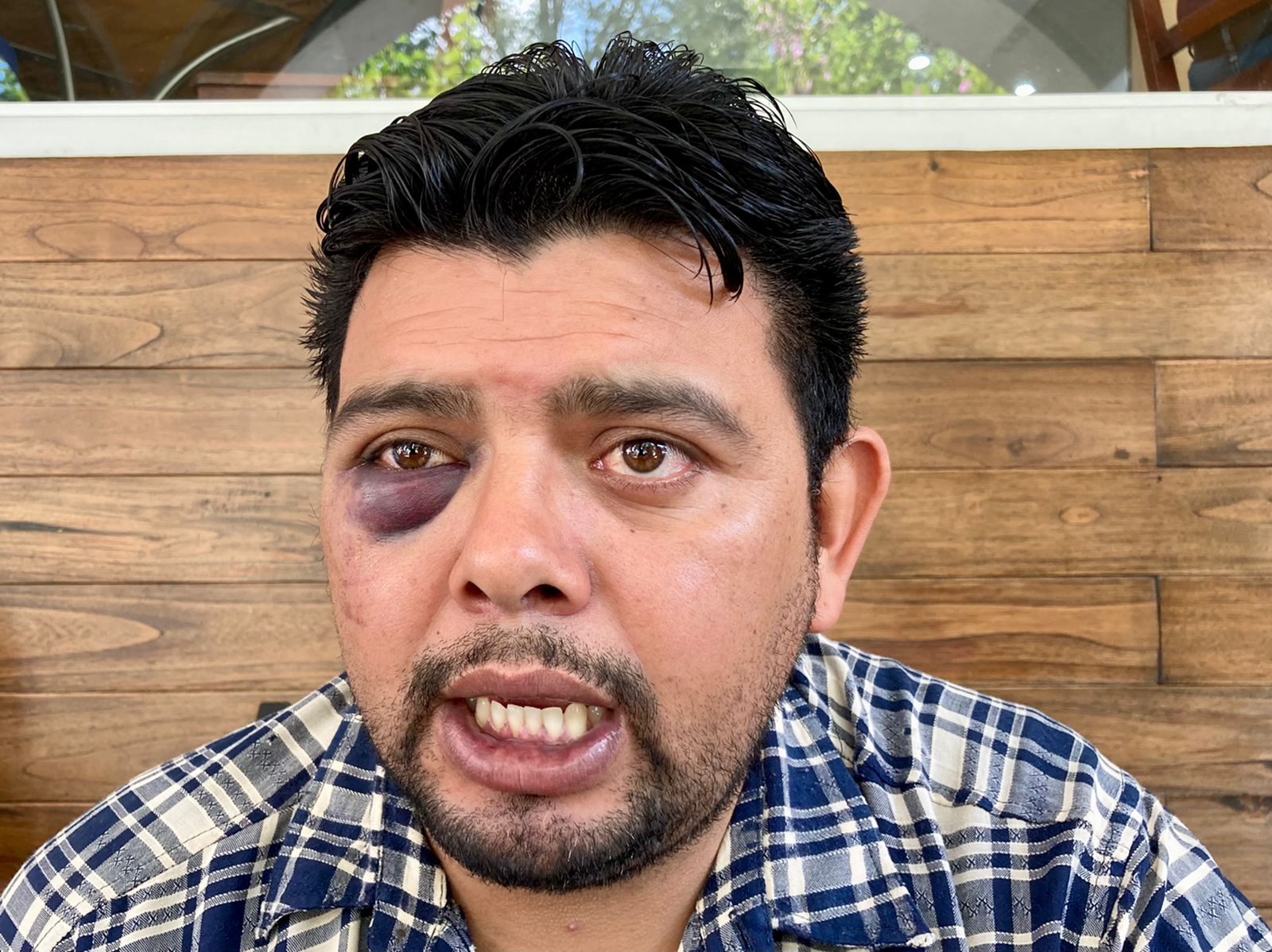 Denuncian a Alcalde de Ayahualulco por golpiza contra un regidor
